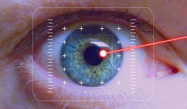 Augenlasern – Chancen und Risiken