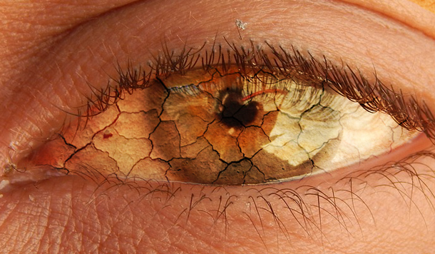 Moderne Diagnostik beim Trockene-Augen-Syndrom